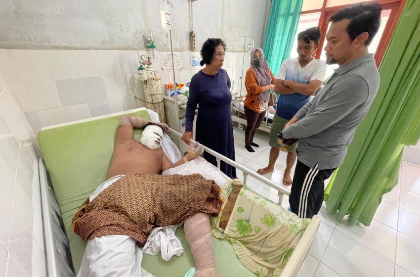 Korban Ledakan Mengalami Luka Serius